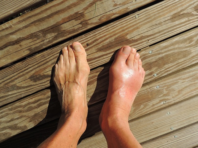 4. Naučte se rozpoznat a léčit bolest nohou efektivně a přirozeně